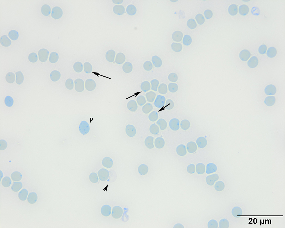 Microscope image: Heinz bodies