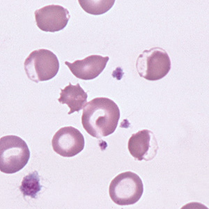 Microscope image: Eccentrocytes